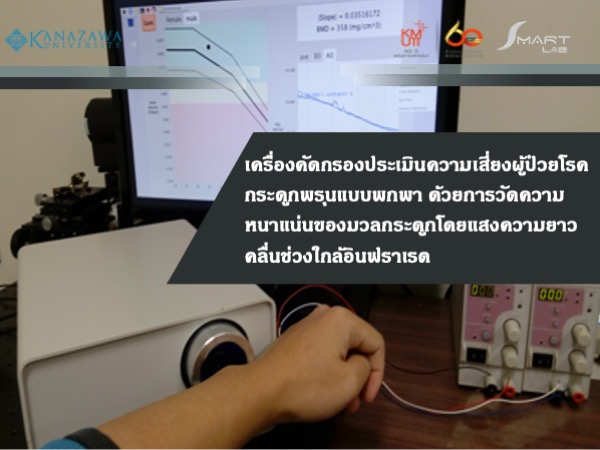 โรคกระดูกพรุนและงานวิจัยเครื่องวัดความหนาแน่นของมวลกระดูก