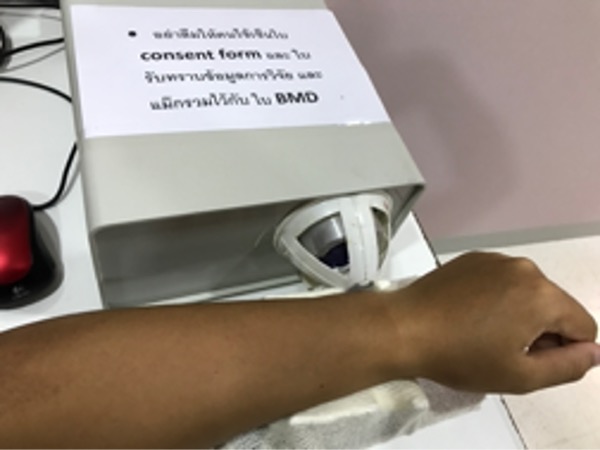 โรคกระดูกพรุนและงานวิจัยเครื่องวัดความหนาแน่นของมวลกระดูก